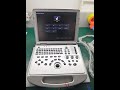 DW-L3 ultrasound machine