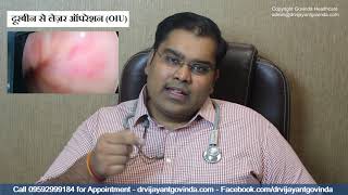 Urethral Stricture treatment in Hindi | लेज़र दूरबीन से पेशाब की नली का इलाज