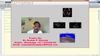 Driver Drowsiness Detection using Image Processing MATLAB PROJECT