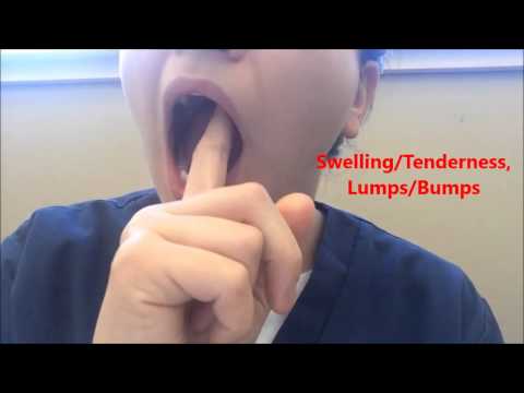 Oral Cancer Self-Exam Oral Cancer Self-Exam