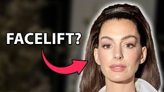 Anne Hathaway's NEW FACE *Updated 2026 Info*