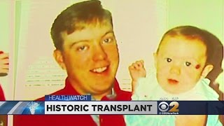 Dr. Max Gomez: Face Transplant