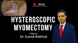 Hysteroscopic Myomectomy | Dr Kunal Rathod