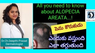 Everything about ALOPECIA AREATA పెను కొరుకుడు ఎలా నివారించాలి       Dr.Deepthi Prasad Dermatologist