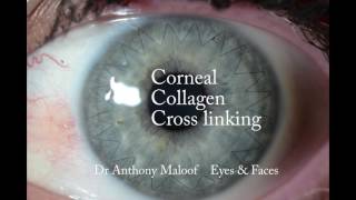 What is Collagen Cross Linking?