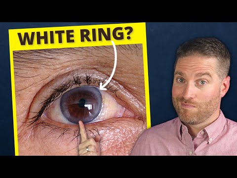 What is the Coloured part around your pupil called?