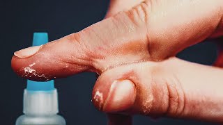 Pourquoi la Superglue Est Parfaite pour la Peau