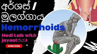 #hemorrhoids#අර්ශස්#medi_talk_with_jayaa#ජයා#මූලග්ගාය#මූලග්ගින්න