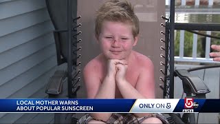 Boy suffers second-degree burns despite applying sunscreen, mom says