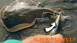 How Does A STINGRAY STING YOU?!