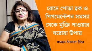 রোদে পোড়া ত্বক ও পিগমেন্টেশন সমস্যা থেকে মুক্তি পাওয়ার উপায় - ঘরোয়া উপকরণ দিয়ে করুন এই উপকারি প্যাক