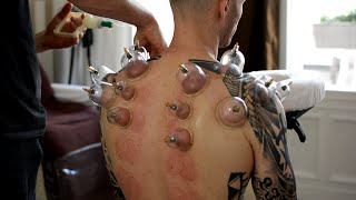 ASMR Chair Massage Back & Neck, No Talking - Cupping Therapy, Gua Sha Pt 2
