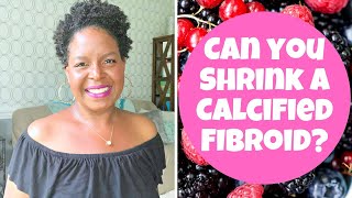 CAN YOU SHRINK A CALCIFIED FIBROID?