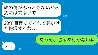 20年間育ててきた義理の母を顔の傷のせいで結婚式に出席させない娘。「絶対に来るな！」と言って、母はその通りに欠席した結果がどうなったか。