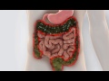 ibs c disease