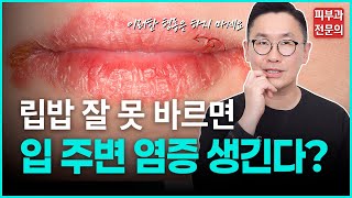 매일 바르는 립밤… 오히려 입 주변 피부염을 부른다고요?