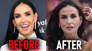 Before & After Photos Of Celebrities Who Regret Taking OZEMPIC