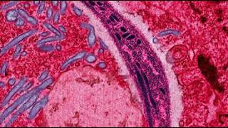 Infectious disease | Wikipedia audio article