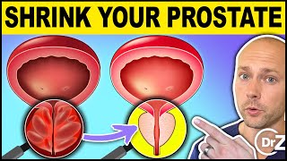 Drink Just 1 CUP PER DAY to Shrink Your Enlarged Prostate