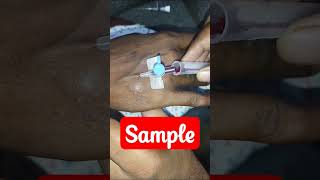 #blood sample #hospital #newvideo #viralvideo #viral