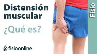 Distensión muscular o ligamentosa - Qué es, cómo sucede y cuáles son sus características