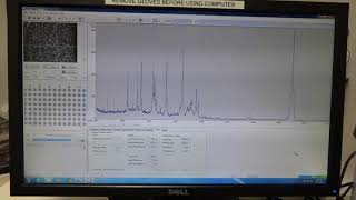 Bruker MIcroflex LT BIotyper automatic BTS calibration