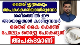 ശരീരത്തിൽ ഈ അടയാളങ്ങൾ കാണുന്നവർ തൈര് കൈ കൊണ്ട് പോലും തൊട്ടു പോകരുത്