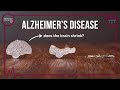 Forget Me Not: Alzheimer's research