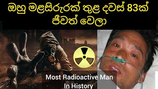 ලෝකයේ අධික විකිරණ මාත්‍රාවකට නිරාවරණය වූ  පුද්ගලයා 83 Days in Hell | Hisashi Ouchi | Inside Cinemax