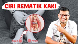 GEJALA KAKI TERKENA SAKIT REMATIK - DOKTER SADDAM ISMAIL