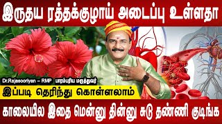 இப்படி சாப்பிட்டால் பிரச்சனை தீரும் | Blood vessels blockage remedy | Dr.Rajasooriyan | Mr Ladies