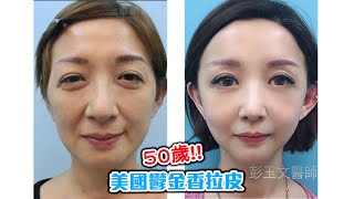 維納斯時尚診所-50歲拉皮後，被誤認成女兒的姊姊！