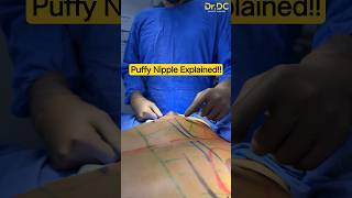 Why Puffy Nipples Appear Flat After Bath or Cold Weather? | Dr DC, Plastic Surgeon Pune, India.