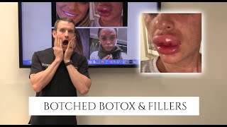 Botox and Fillers Gone Wrong!! | Dr. Daniel Barrett Discusses Botched Injectables Gone Wrong