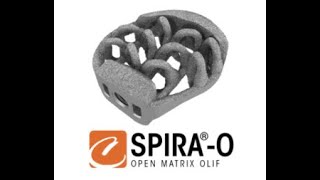 Camber Spine: Spira O