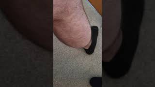 benign fasciculation syndrome - calf muscles