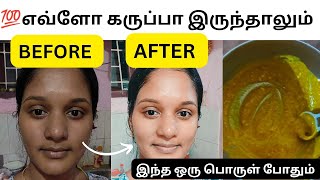 💯 ஒரு நொடி போதுங்க 🧚 இனிமே வீட்டுல skin whighteninga பண்ணலாம் 👍... @Vickymanju861