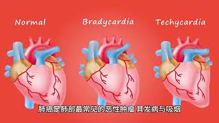 这些癌症可能会遗传！提醒：父母患有以下几种，要早做体检