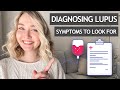 DIAGNOSING LUPUS | Symptoms and Tests