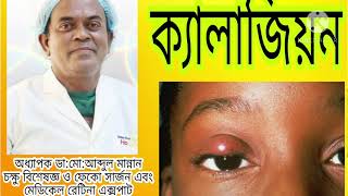 চোখের পাতার রোগ ও চিকিৎসা ★ অধ্যাপক ডা:মো:আব্দুল মান্নান চক্ষু বিশেষজ্ঞ ও ফেকো সার্জন।