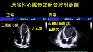 原發性心臟病-超音波檢查對照圖-1