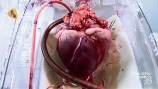 7 Amazing Facts You Don't Know About your Heart ! (3D Animation )