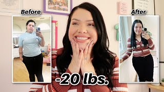 I LOST 20 LBS IN 2 WEEKS!! 😱* Surgery Update*