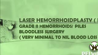 LASER PILES SURGERY ( HEMORRHOIDPLASTY) BIOLITEC LASER BY DR SANDIP BANERJEE, PELVINIC #laser #piles