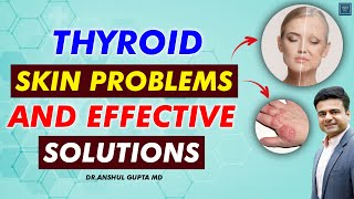 Thyroid Skin Problems : How To Cure Thyroid Skin Problems ?