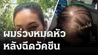 สาวผมร่วงหมดหัว-พบแพทย์ศิริราช | 22-12-64 | ไทยรัฐนิวส์โชว์