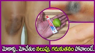 మోచేతులు, మోకాళ్ళ పై ఉన్న నలుపు పోవాలంటే.. I Get rid of Black Knees \u0026 Elbows I Everything in Telugu