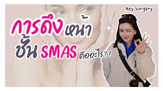 การดึงหน้าชั้น SMAS คืออะไร?? 🤔