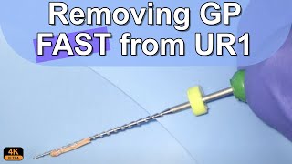 How to remove gutta percha - LIVE VIDEO | I ❤️ the pulp