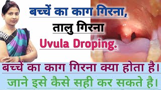 बच्चे का काग गिरना / तालु गिरना क्या होता है व कैसे सही करे। Uvula Droping.